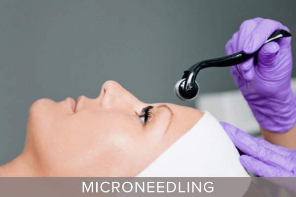 Click here to view our microneedling treatments